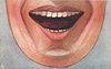 Image 1 - chin and open mouth