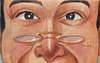 Image 1 - upper face with spectacles