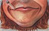 Image 1 - chin and mouth smoking cigarette